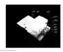 Fig. 01 - Unitary biochip providing sample-in to results-out processing and methods of manufacture