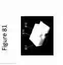 Fig. 82 - Unitary biochip providing sample-in to results-out processing and methods of manufacture