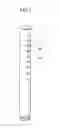 Fig. 02 - Spout apparatus