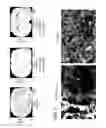 Fig. 03 - Spraying system and methods of use thereof