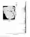 Fig. 07 - Spraying system and methods of use thereof