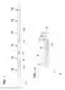 Fig. 02 - Coating apparatus and method of coating joint