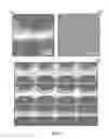 Fig. 09 - Tissue engineering device and construction of vascularized dermis