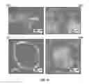 Fig. 10 - Tissue engineering device and construction of vascularized dermis