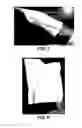 Fig. 06 - TWO-SIDED CLEANING IMPLEMENT