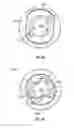 Fig. 36 - Fastener cartridge