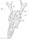Fig. 01 - Skull mount for use in skull mounting