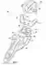 Fig. 05 - Skull mount for use in skull mounting