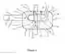 Fig. 05 - Tire chain and components thereof