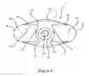 Fig. 08 - Tire chain and components thereof