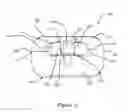 Fig. 12 - Tire chain and components thereof