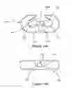 Fig. 14 - Tire chain and components thereof