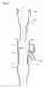 Fig. 05 - Fuel supply apparatus