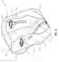 Fig. 10 - Airbag systems with passive venting control