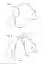 Fig. 03 - Airbag