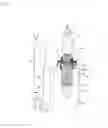 Fig. 04 - Conveyance system and system for inspecting article to be conveyed