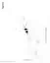 Fig. 08 - Methods of treating cardiovascular disease with an ASGR inhibitor