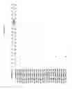 Fig. 3404 - Methods of treating cardiovascular disease with an ASGR inhibitor