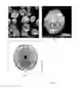 Fig. 04 - Shape controlled pro-catalyst and a single pot process for preparing the same