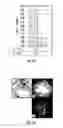 Fig. 09 - Generation of induced pluripotent stem cells from small volumes of peripheral blood