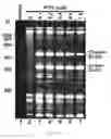 Fig. 06 - RECOMBINANT RNA PRODUCTION