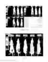 Fig. 05 - Compositions and methods for the detection or treatment of uterine leiomyosarcoma