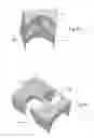 Fig. 06 - ARRANGEMENT FOR FEEDING COMMINUTED MATERIAL USING A PLUG SCREW FEEDER