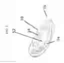 Fig. 03 - Fracturing ball retrieval device and method