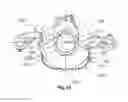 Fig. 10 - Positioning the switching element for a mechanically switched VCR connecting rod