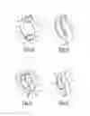 Fig. 06 - Element of an exhaust line comprising valve with added stoppers