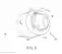 Fig. 04 - High-speed snap ring and snap ring retention method