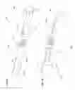 Fig. 10 - Sink and shower handle restraint