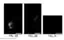 Fig. 04 - Protein retention expansion microscopy