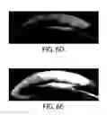 Fig. 16 - Protein retention expansion microscopy