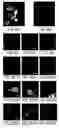 Fig. 20 - Protein retention expansion microscopy