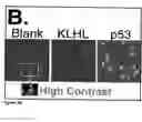 Fig. 05 - Global proteomic screening of random bead arrays using mass spectrometry imaging