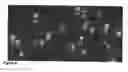Fig. 06 - Global proteomic screening of random bead arrays using mass spectrometry imaging