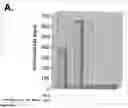 Fig. 08 - Global proteomic screening of random bead arrays using mass spectrometry imaging