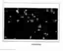Fig. 28 - Global proteomic screening of random bead arrays using mass spectrometry imaging