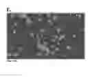Fig. 29 - Global proteomic screening of random bead arrays using mass spectrometry imaging