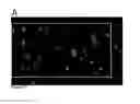 Fig. 30 - Global proteomic screening of random bead arrays using mass spectrometry imaging