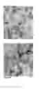 Fig. 32 - Global proteomic screening of random bead arrays using mass spectrometry imaging