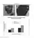 Fig. 12 - Methods and compositions for wound treatment