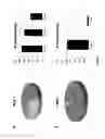 Fig. 11 - BCL6 expression in eutopic endometrium as a marker for endometriosis and subfertility