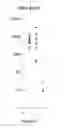 Fig. 25 - Method of diagnosing prostate cancer by detecting chemical elements