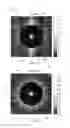Fig. 05 - Magnetic resonance imaging system and method