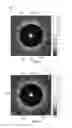 Fig. 07 - Magnetic resonance imaging system and method