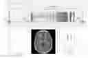Fig. 01 - AQUEOUS CONTRAST AGENTS FOR DYNAMIC MRI AND MRA