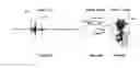 Fig. 06 - Ultrasonic imaging devices and methods