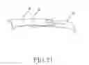 Fig. 22 - Curved body and wearable device therewith